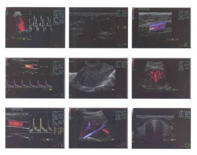 CE/ISO-godkjent ultralyddiagnosesystem (MT01006013)