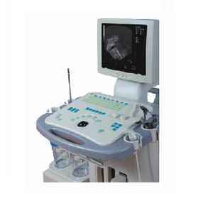 CE/ISO-godkjent Gyn Visible Ultrasonic Diagnostic System Machine (MT01006081)